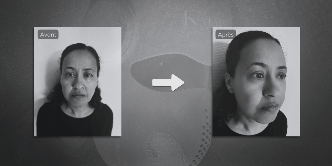 Masque LED visage : quels résultats attendre dans le temps ?