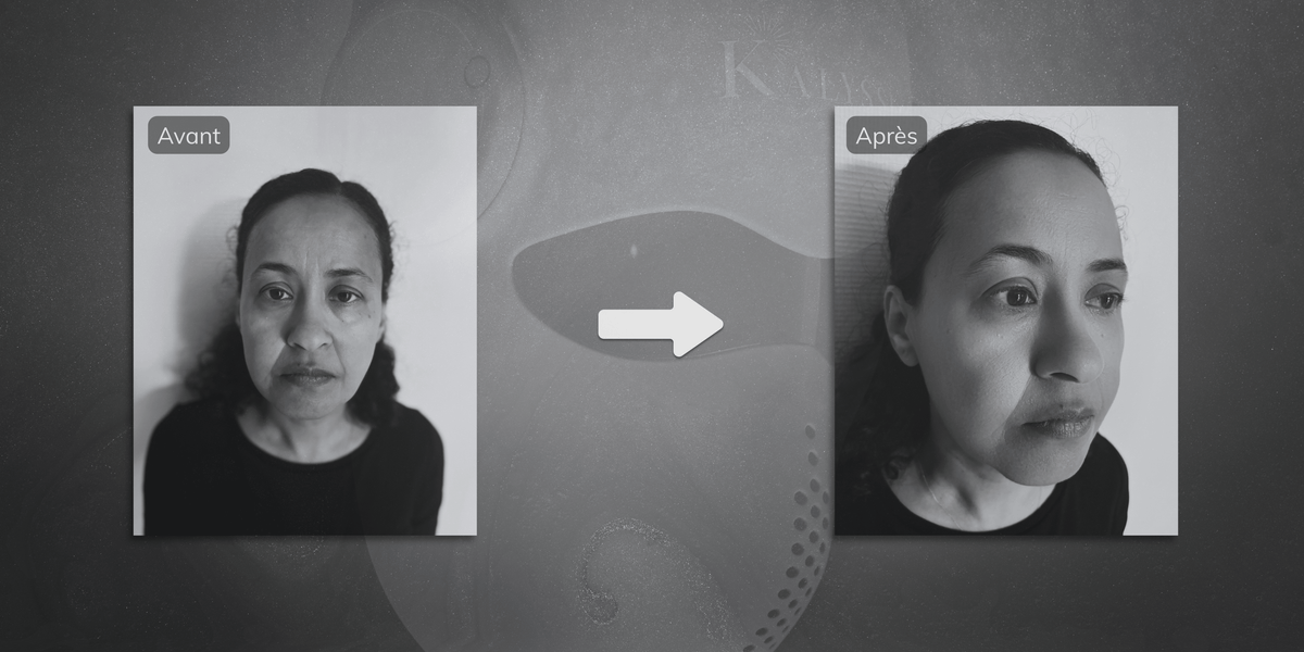 Masque LED visage : quels résultats attendre dans le temps ?